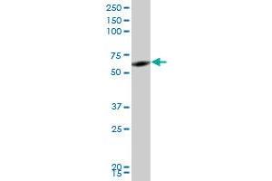 RNF2 monoclonal antibody (M05), clone 2B6. (RNF2 抗体  (AA 192-290))
