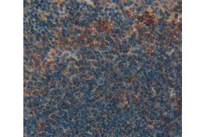 Used in DAB staining on fromalin fixed paraffin- embedded Kidney tissue (GRPR 抗体  (AA 1-116))
