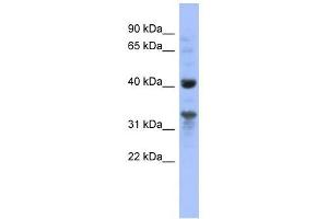 MRPL37 antibody used at 1 ug/ml to detect target protein. (MRPL37 抗体  (N-Term))