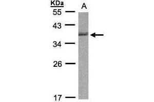 WB Image Sample (30μg whole cell lysate) A:Raji , 12% SDS PAGE antibody diluted at 1:1000 (CDC34 抗体)