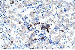 Human kidney; ABT1 antibody - middle region in Human kidney cells using Immunohistochemistry (Activator of Basal Transcription 1 抗体  (Middle Region))