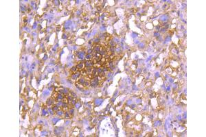 Paraformaldehyde-fixed, paraffin embedded mouse placenta section, Antigen retrieval by boiling in sodium citrate buffer (pH6. (YWHAE 抗体)