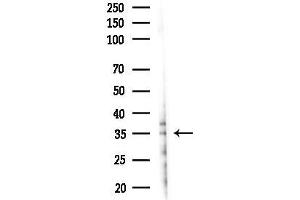 anti-Toll-Interleukin 1 Receptor (TIR) Domain Containing Adaptor Protein (TIRAP) (pTyr106) antibody