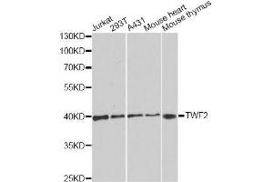 Western blot analysis of extracts of various cell lines, using TWF2 antibody. (TWF2 抗体  (AA 1-369))