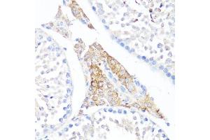 Immunohistochemistry of paraffin-embedded mouse testis leydig using Fibronectin antibody (ABIN7267194) at dilution of 1:100 (40x lens).