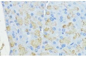 Immunohistochemistry of paraffin-embedded Mouse pancreas using SOD3 Polyclonal Antibody at dilution of 1:100 (40x lens). (SOD3 抗体)