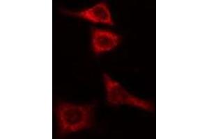 ABIN6274987 staining COLO205 cells by IF/ICC. (CEP135 抗体  (C-Term))