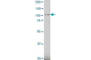 KIAA0317 polyclonal antibody (A01), Lot # 051207JC01 Western Blot analysis of KIAA0317 expression in U-2 OS . (AREL1 抗体  (AA 24-123))