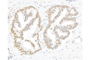 Immunohistochemistry (IHC) image for anti-Replication Protein A2, 32kDa (RPA2) (pSer4), (pSer8) antibody (ABIN7449013)