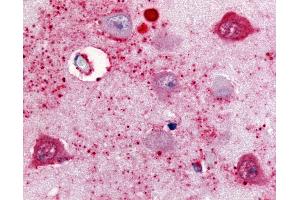Anti-SSTR2 antibody IHC of human brain, subiculum neurons. (SSTR2 抗体  (Cytoplasmic Domain))