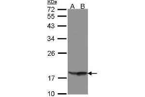 WB Image Sample(30 μg of whole cell lysate) A:Raji, B:MOLT4, 12% SDS PAGE antibody diluted at 1:1000 (RARRES3 抗体  (C-Term))