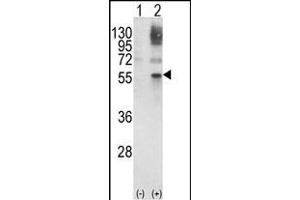 Western blot analysis of GATA2 (arrow) using rabbit polyclonal GATA2 Antibody (Center) (ABIN652243 and ABIN2841006). (GATA2 抗体  (AA 262-288))