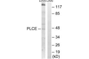 Western Blotting (WB) image for anti-1-Acylglycerol-3-Phosphate O-Acyltransferase 5 (Lysophosphatidic Acid Acyltransferase, Epsilon) (AGPAT5) (Internal Region) antibody (ABIN1850516) (AGPAT5 抗体  (Internal Region))