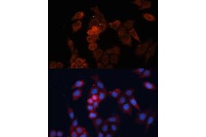 Immunofluorescence analysis of HeLa cells using HSP27/HSP27/HSPB1 antibody (ABIN7267568) at dilution of 1:100.