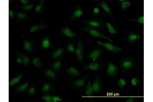 Image no. 2 for anti-Nucleoporin 133kDa (NUP133) (AA 1069-1156) antibody (ABIN599269) (NUP133 抗体  (AA 1069-1156))