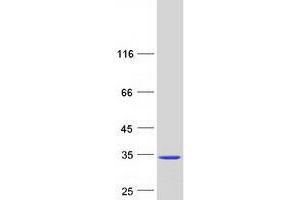 Western Blotting (WB) image for Uroporphyrinogen III Synthase (UROS) protein (Myc-DYKDDDDK Tag) (ABIN2735076)