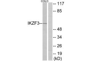Western blot analysis of extracts from COLO cells, using IKZF3 antibody. (IKZF3 抗体  (Internal Region))