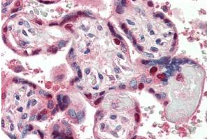 Human Placenta (formalin-fixed, paraffin-embedded) stained with DDB1 antibody ABIN396934 at 5 ug/ml followed by biotinylated anti-mouse IgG secondary antibody ABIN481714, alkaline phosphatase-streptavidin and chromogen. (DDB1 抗体)