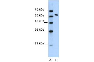 WB Suggested Anti-SUPT16H Antibody Titration: 1. (SUPT16H 抗体  (N-Term))