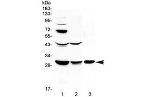 Western blot testing of 1) rat liver, 2) rat kidney and 3) mouse kidney lysate with TL1A antibody at 0. (TNFSF15 抗体)