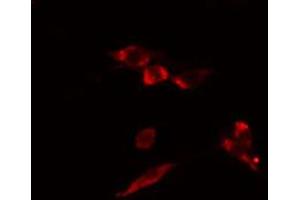 ABIN6274466 staining HuvEc cells by IF/ICC. (MKL1 抗体  (N-Term))