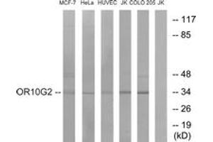 Western blot analysis of extracts from HuvEc/HeLa/MCF-7/Jurkat/COLO cells, using OR10G2 Antibody. (OR10G2 抗体  (AA 241-290))