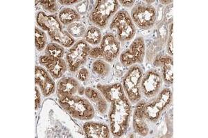 Immunohistochemical staining of human kidney with IL22RA2 polyclonal antibody  shows moderate cytoplasmic staining and luminal membrane positivity in tubules. (IL22RA2 抗体)