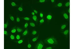 Immunofluorescence analysis of A549 cell using UBE2V1 antibody. (UBE2V1 抗体)