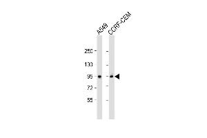 All lanes : Anti-CD71 Antibody (C-term) at 1:2000 dilution Lane 1: A549 whole cell lysate Lane 2: CCRF-CEM whole cell lysate Lysates/proteins at 20 μg per lane. (Transferrin Receptor 抗体  (C-Term))