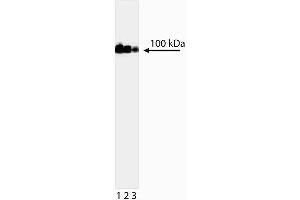 Western blot analysis of DNA Topoisomerase I. (Topoisomerase I 抗体)