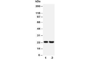 Western blot testing of FGF9 antibody and Lane 1:  rat brain;  2: HeLa;  Predicted size: 23KD;  Observed size: 23KD (FGF9 抗体  (Middle Region))