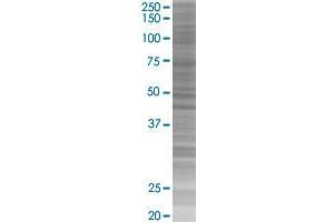 ANGPTL7 293T Cell Transient Overexpression Lysate(Denatured)