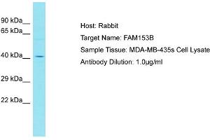 Host: Rabbit Target Name: FAM153B Sample Type: MDA-MB-435s Whole cell lysates Antibody Dilution: 1. (FAM153B 抗体  (C-Term))