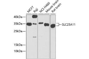 Western blot analysis of extracts of various cell lines, using SLC25 antibody (ABIN6132660, ABIN6147903, ABIN6147904 and ABIN6224187) at 1:1000 dilution. (SLC25A11 抗体  (AA 1-314))