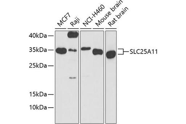 SLC25A11 Antikörper  (AA 1-314)