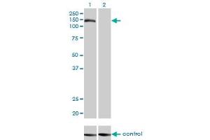 Western blot analysis of TMEM1 over-expressed 293 cell line, cotransfected with TMEM1 Validated Chimera RNAi (Lane 2) or non-transfected control (Lane 1). (TRAPPC10 抗体  (AA 1162-1257))