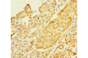 Immunohistochemistry of paraffin-embedded human pancreatic tissue using ABIN7176608 at dilution of 1:100 (ZKSCAN2 抗体  (AA 1-300))