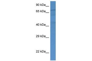 WB Suggested Anti-FAF1 AntibodyTitration: 1. (FAF1 抗体  (Middle Region))