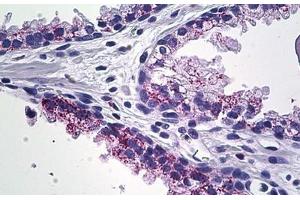 Human Prostate: Formalin-Fixed, Paraffin-Embedded (FFPE) (MMP23B 抗体  (C-Term))