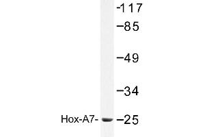 Image no. 1 for anti-Homeobox A7 (HOXA7) antibody (ABIN272304) (HOXA7 抗体)