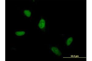 Immunofluorescence of  purified  MaxPab antibody to ZSCAN5 on HeLa cell. (ZSCAN5A 抗体  (AA 1-496))
