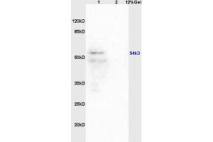 Lane 1: mouse brain lysates Lane 2: mouse heart lysates probed with Anti Iroquois homeobox protein 3 Polyclonal Antibody, Unconjugated (ABIN872921) at 1:200 in 4 °C. (IRX3 抗体  (AA 401-501))