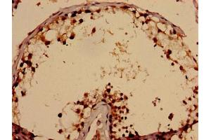 Immunohistochemistry analysis of human testis tissue using ABIN7171638 at dilution of 1:100 (TBC1D31 抗体  (AA 662-1001))