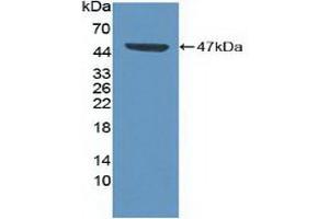 Detection of Recombinant CDK8, Human using Polyclonal Antibody to Cyclin Dependent Kinase 8 (CDK8) (CDK8 抗体  (AA 21-392))