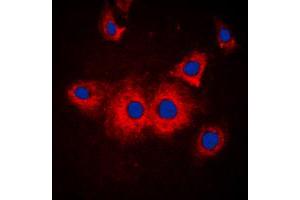 Immunofluorescent analysis of SLK staining in MCF7 cells. (SLK 抗体  (C-Term))