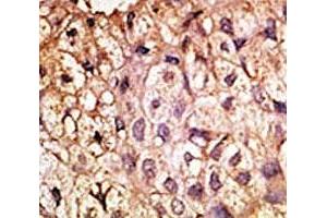 Immunohistochemistry (IHC) image for anti-Angiotensin I Converting Enzyme 2 (ACE2) (AA 59-90) antibody (ABIN3029962)