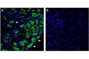 Expression of Plexin-C1 in in rat dorsal root ganglion. (Plexin C1 抗体  (Extracellular, N-Term))