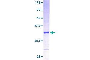 RPL5 Protein (AA 1-101) (GST tag)