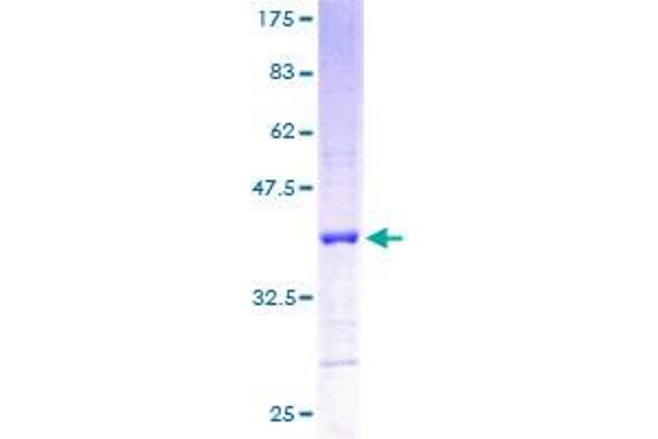 RPL5 Protein (AA 1-101) (GST tag)