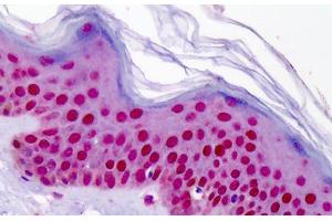 Human Skin: Formalin-Fixed, Paraffin-Embedded (FFPE) (Aryl Hydrocarbon Receptor 抗体  (AA 2-51))